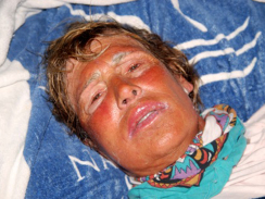 Diana Nyad after being pulled from the water on her last Havana to Key West attempt