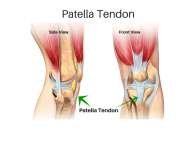 patella-tendon-canva-1